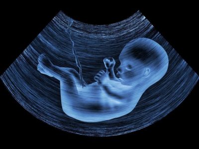 20014989 - ultrasound image of baby in mother's womb